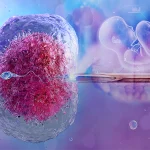 IVF (آی وی اف)