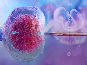 IVF (آی وی اف)