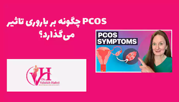PCOS چگونه بر باروری تاثیر می‌گذارد؟
