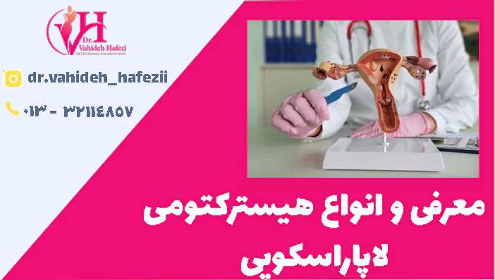 معرفی و انواع هیسترکتومی لاپاراسکوپی