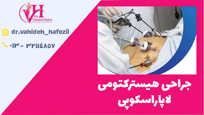 جراحی هیسترکتومی لاپاراسکوپی