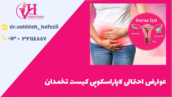 عوارض احتمالی لاپاراسکوپی کیست تخمدان