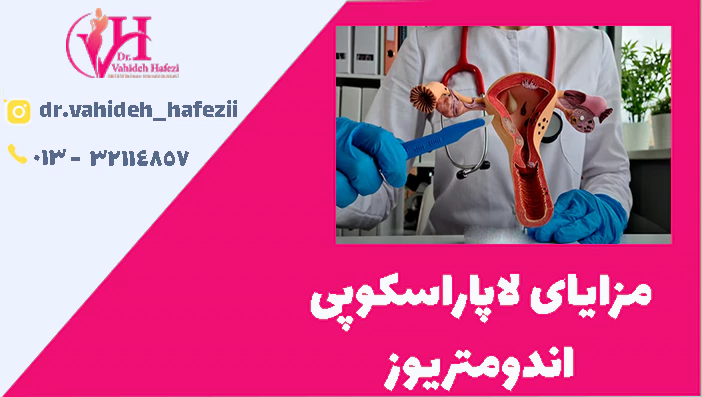 مزایای لاپاراسکوپی اندومتریوز