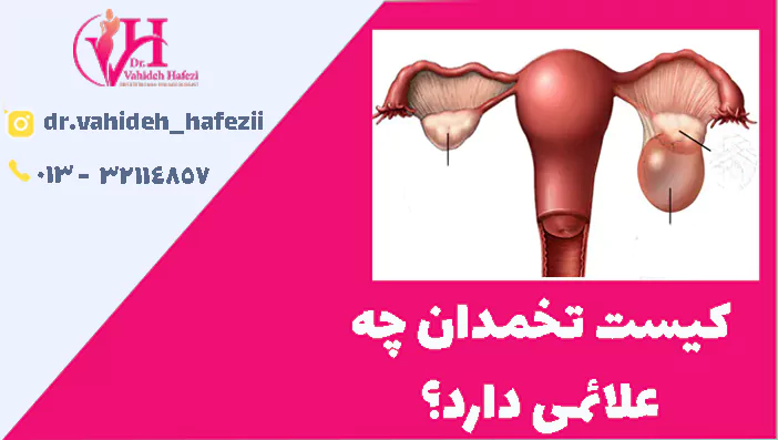 کیست تخمدان چه علائمی دارد؟
