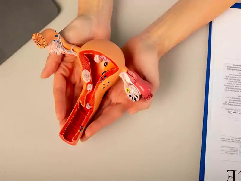 اقداماتی قبل از لاپاراسکوپی رحم