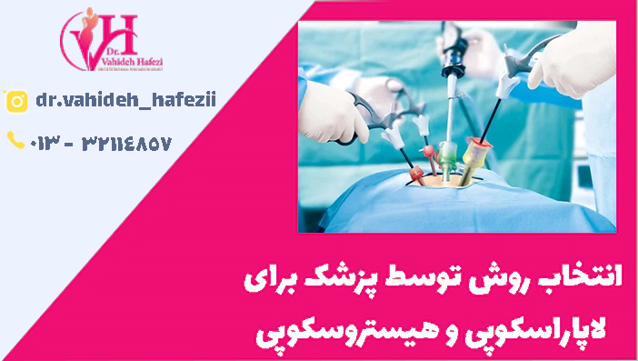 انتخاب روش توسط پزشک برای
 لاپاراسکوپی و هیستروسکوپی