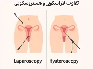 تفاوت لاپاراسکوپی و هیستروسکوپی