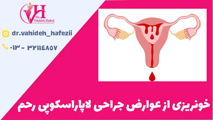 خونریزی از عوارض جراحی لاپاراسکوپی رحم