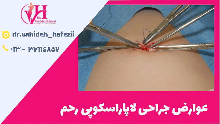عوارض جراحی لاپاراسکوپی رحم