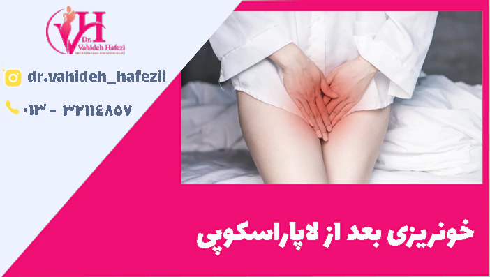 خونریزی بعد از لاپاراسکوپی