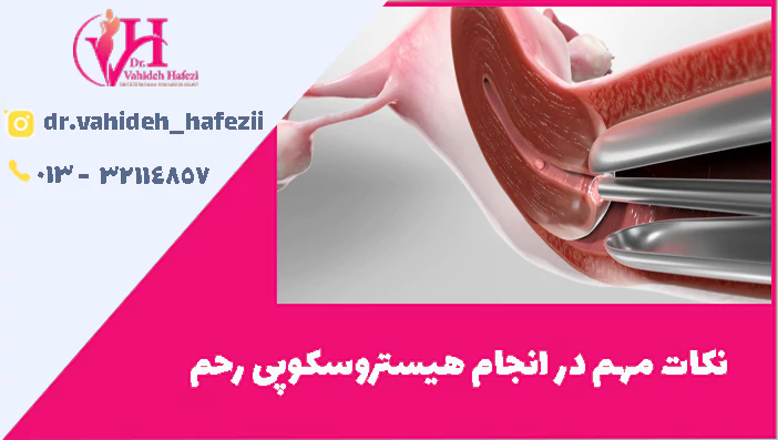 نکات مهم در انجام هیستروسکوپی رحم