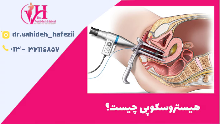 هیستروسکوپی چیست؟