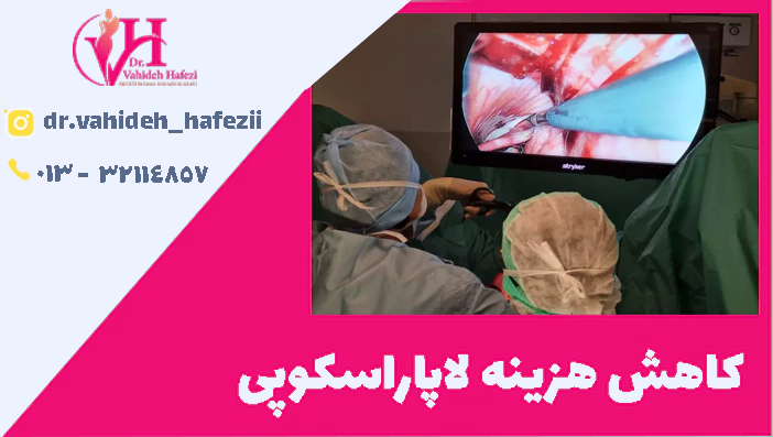 کاهش هزینه لاپاراسکوپی رحم
