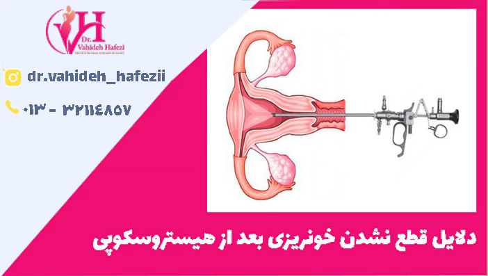 دلایل قطع نشدن خونریزی بعد از هیستروسکوپی