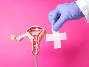 عوارض بعد از عمل هیستروسکوپی