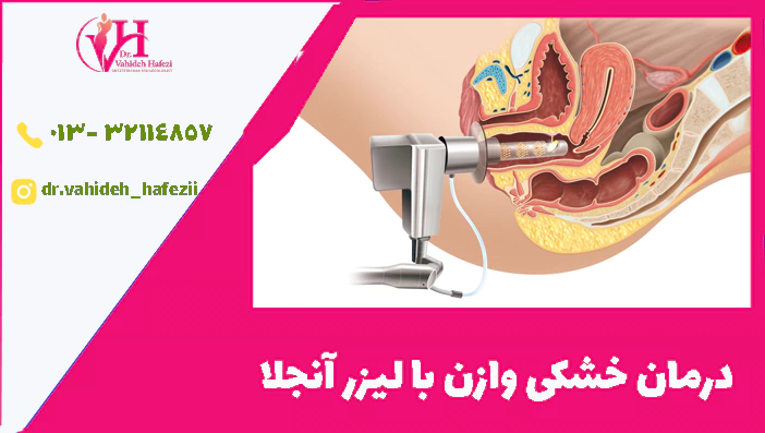 درمان خشکی وازن با لیزر آنجلا ؟؟