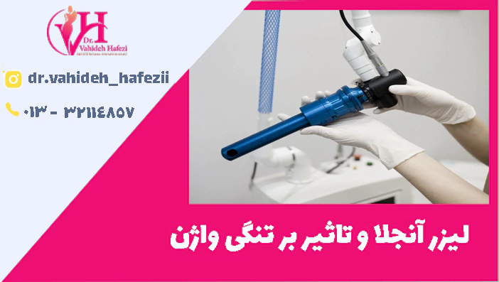 لیزر آنجلا و تاثیر بر تنگی واژن